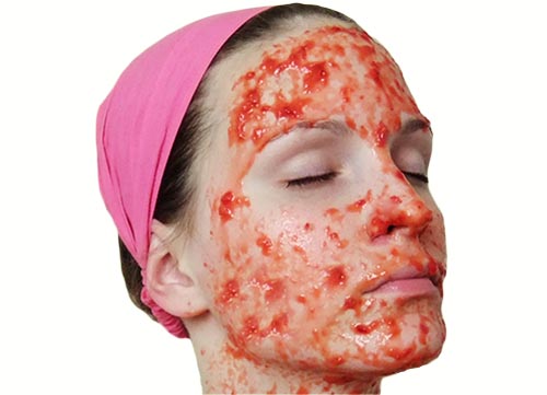 cara menghilangkan sunburn