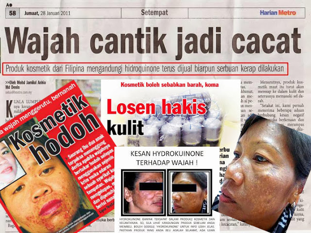 Atasi masalah kulit kerana produk kosmetik