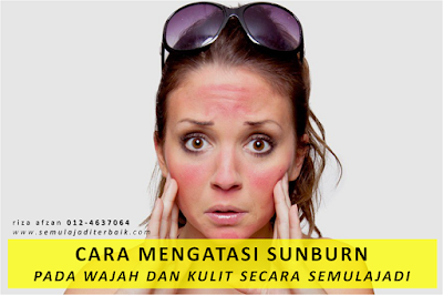 cara mengatasi sunburn pada wajah dan kulit
