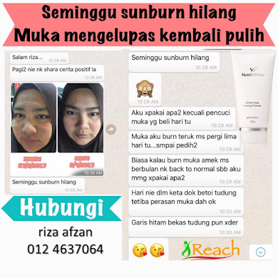 kulit mengelupas pulih cepat