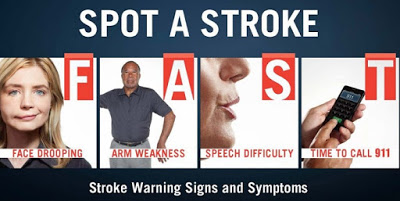 sakit kepala kuat tanda stroke