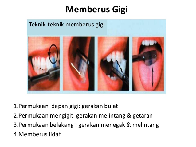 gusi-berdarah