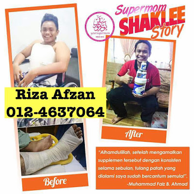 tulang retak cepat pulih